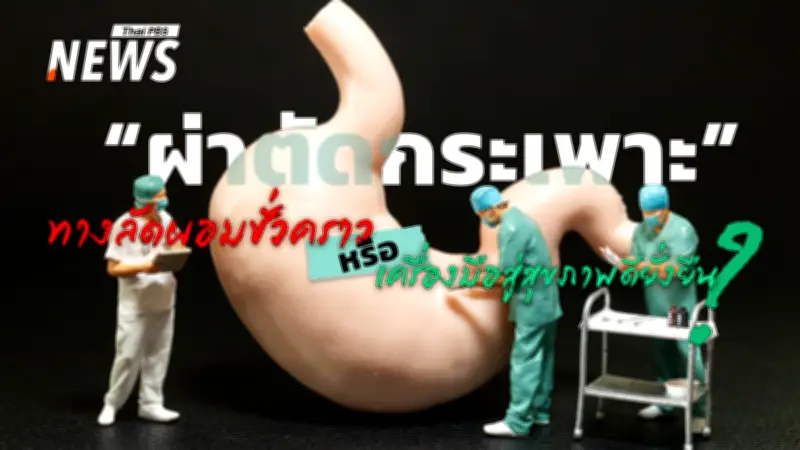 ผ่าตัดกระเพาะอาหารทางเลือกลดน้ำหนักยั่งยืน ช่วยรักษาโรคอ้วนและโรคแทรกซ้อน