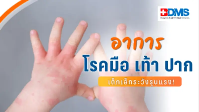 เตือนภัย! โรคมือ เท้า ปาก อันตรายถึงชีวิตในเด็กเล็ก ป้องกันได้ด้วยวัคซีน