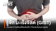 มะเร็ง GIST ภัยเงียบหลังการจากไปของ 'แม็ค รชต' หมอเจดแนะวิธีสังเกต 5 สัญญาณเตือน
