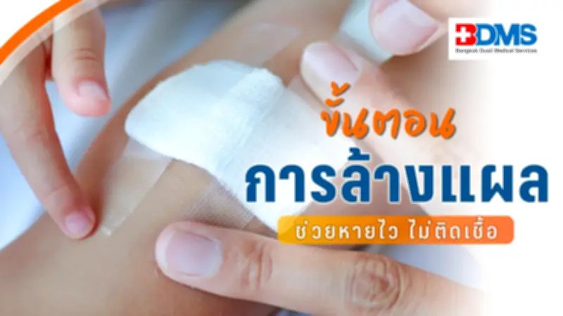 สุขภาพกายดี แผลหายไว ไม่ติดเชื้อ! ขั้นตอนล้างแผลที่ถูกต้อง ลดอักเสบ-โอกาสเป็นหนอง