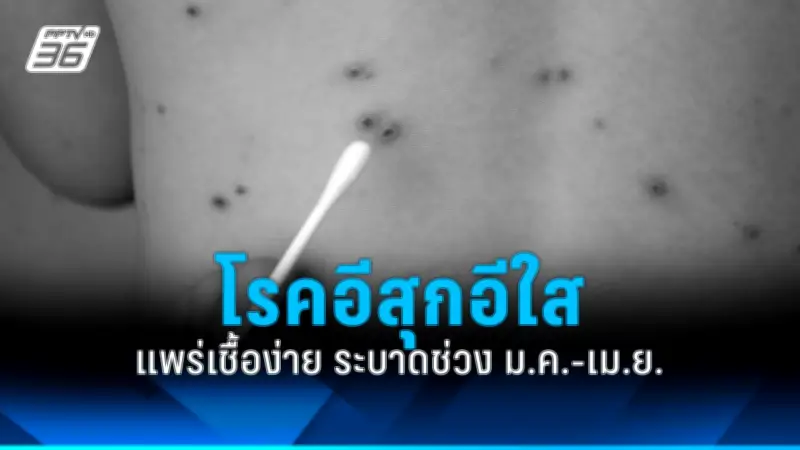สหรัฐฯ ประกาศมาตรการคว่ำบาตรใหม่ หลังรัสเซียโจมตีโรงพยาบาลในยูเครน