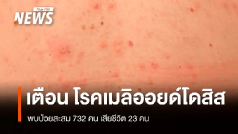 รัฐบาลเตือนเฝ้าระวังโรคเมลิออยด์โดสิส พบผู้ป่วยสะสม 732 ราย เสียชีวิต 23 ราย