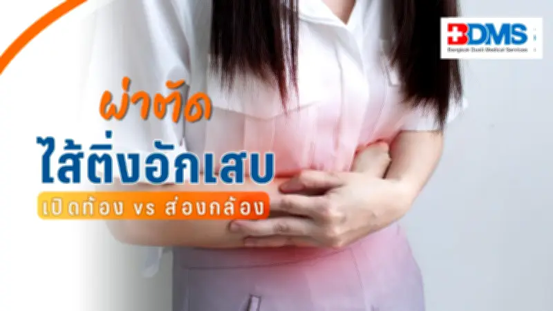 ไส้ติ่งอักเสบต้องผ่าไหม? ปวดท้องขวาล่างอย่าชะล่าใจ เสี่ยงแตกถึงชีวิต