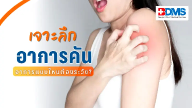 เจาะลึกอาการคัน สาเหตุและวิธีป้องกัน สัญญาณอันตรายที่ควรพบแพทย์