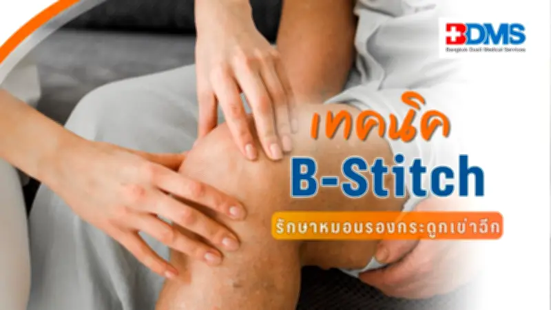 เทคนิคผ่าตัดส่องกล้อง B-Stitch ทางเลือกใหม่ซ่อมหมอนรองเข่าผู้สูงอายุ ฟื้นตัวเร็วใน 6-7 สัปดาห์