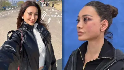 โย ยศวดี อัปหน้าสุดปังที่เกาหลีวัย 47 เปิดภาพล่าสุดหลังศัลยกรรม 3 วัน