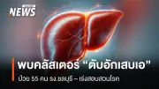 กรมควบคุมโรคเร่งสอบสวนคลัสเตอร์ตับอักเสบเอโรงงานชลบุรี ป่วย 55 คน คาดปนเปื้อนน้ำ-อาหาร