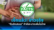 เปิดวิธีดูแลสุขภาพช่องปากผู้สูงอายุ ป้องกันฟันผุ เหงือกอักเสบ