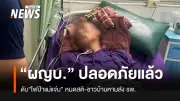 ผู้ใหญ่บ้านหมดสติขณะดับไฟป่าเชียงใหม่ ชาวบ้านช่วยลำเลียงออกจากพื้นที่ห่างไกล