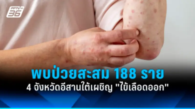 อาหารเสริมลดน้ำหนักยอดฮิต เสี่ยงตับพัง พบผู้ป่วยเพิ่มขึ้น