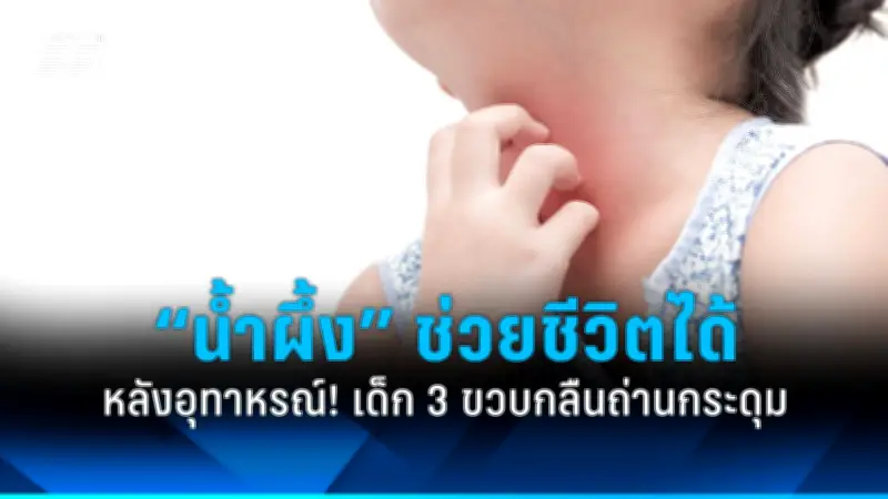 เตือนภัย! ไข้ทรพิษลิงระบาดในไทย ต้องเฝ้าระวังใกล้ชิด