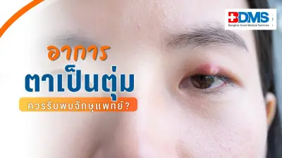 เช็กตุ่มที่เปลือกตาแบบไหนอันตราย ควรรีบพบจักษุแพทย์