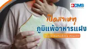 ดูแลสุขภาพกายและใจ: เทคนิคเลือกอาหารตามกรุ๊ปเลือดและป้องกันไมเกรน