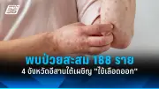 อาหารเสริมลดน้ำหนักยอดฮิต เสี่ยงตับพัง พบผู้ป่วยเพิ่มขึ้น