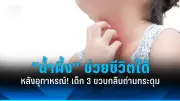 เตือนภัย! ไข้ทรพิษลิงระบาดในไทย ต้องเฝ้าระวังใกล้ชิด