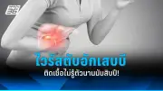 รู้จัก 'ไข้หวัดใหญ่สุนัข' อาการคล้ายหวัดคน ติดต่อจากหมา