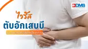 ไวรัสตับอักเสบบี ภัยเงียบสู่มะเร็งตับ แนะตรวจ-ฉีดวัคซีนป้องกัน