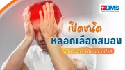 โรคหลอดเลือดสมอง ชนิดขาดเลือดและเลือดออก อาการต่างกัน