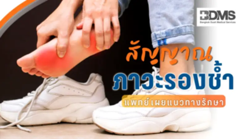 รองช้ำหายเองได้ไหม? แนวทางรักษาและสัญญาณที่ควรรีบพบแพทย์