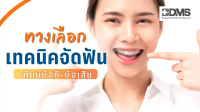 เทียบจัดฟัน 4 แบบ โลหะ เซรามิก ดามอน Invisalign ข้อดี-ข้อเสีย เลือกแบบไหนดี