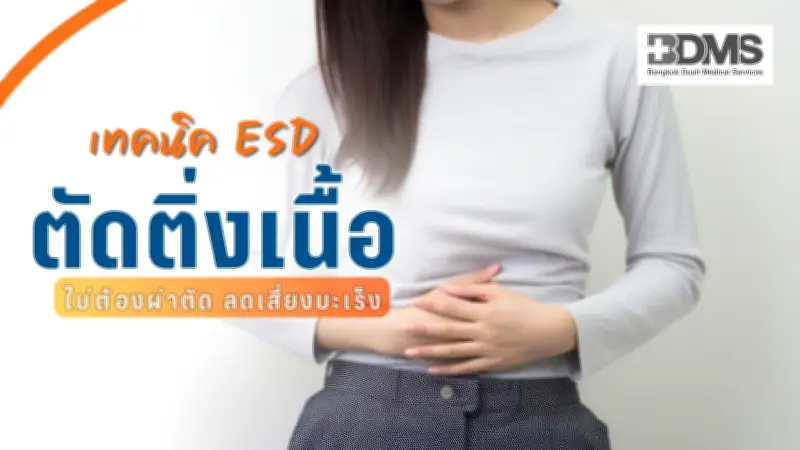เทคนิค ESD ตัดติ่งเนื้อทางเดินอาหาร ไม่ต้องผ่าตัด ลดเสี่ยงมะเร็ง