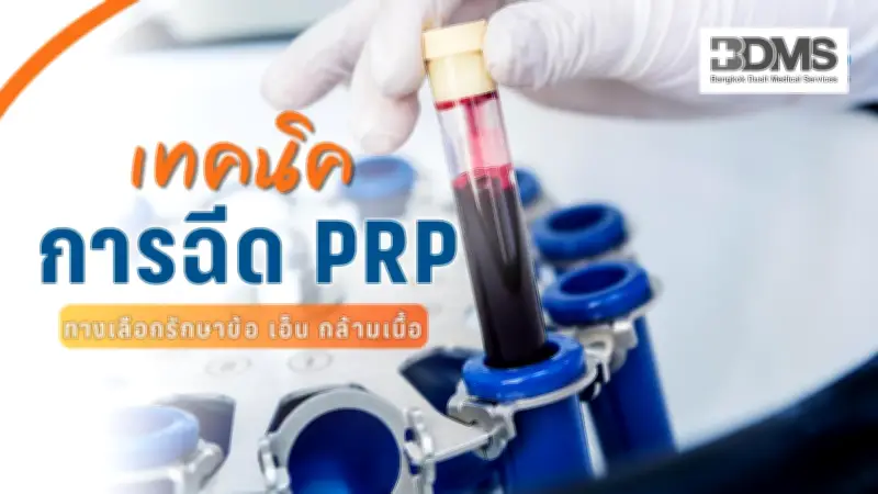เทคนิคฉีด PRP ฟื้นฟูข้อ เอ็น กล้ามเนื้อ ด้วยเกล็ดเลือดตัวเอง ความปลอดภัยสูง