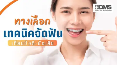 เทียบจัดฟัน 4 แบบ โลหะ เซรามิก ดามอน Invisalign ข้อดี-ข้อเสีย เลือกแบบไหนดี