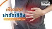 เนื้องอกมดลูกหายเองได้ไหม? เปิดข้อเท็จจริงที่ผู้หญิงควรรู้