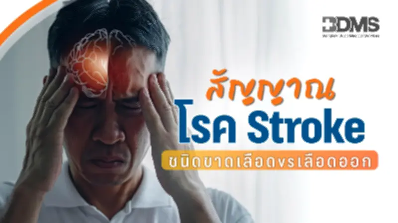 Stroke ชนิดขาดเลือด vs เลือดออก: ต่างกันอย่างไร? สัญญาณอันตรายที่ต้องรู้