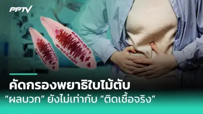 หมอกควัน PM2.5 พุ่งสูง ส่งผลกระทบต่อสุขภาพประชาชน