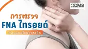 FNA ไทรอยด์คืออะไร? เจ็บไหม? ตรวจก้อนไทรอยด์ด้วยเข็มเล็ก ช่วยวินิจฉัยมะเร็ง
